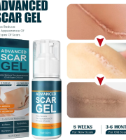 (২ পিস) অ্যাডভান্স স্কার জেল -দাগ দূর করার ম্যাজিক জেল